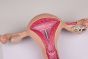 Uterusmodell Erler Zimmer