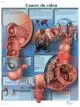Anatomische Bord : Krebs Klon VR2432L