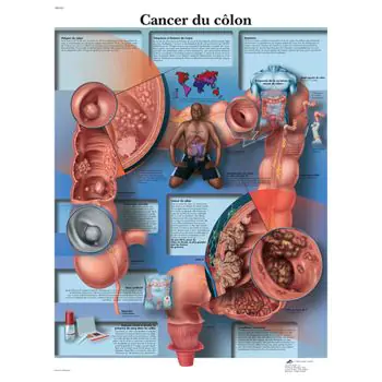 Anatomische Bord : Krebs Klon VR2432L