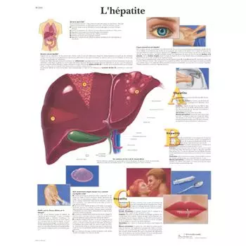 Anatomische Bord : Hepatitis VR2435L