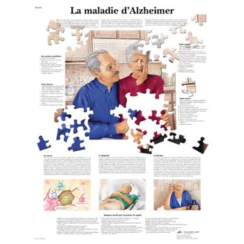 Anatomischen Bord : Alzheimer-Krankheit VR2628L