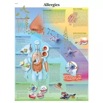 Anatomische Bord : Allergien VR2660L