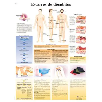 Anatomische Bord : Dekubitus VR2717UU