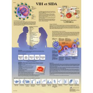 Anatomische Bord : HIV und AIDS VR2725L